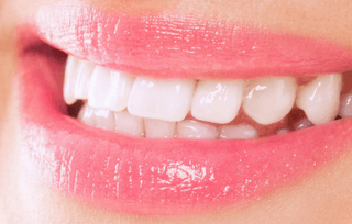 An orthodontics patient after braces with a beautiful smile