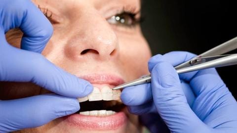 Ceramic Braces background